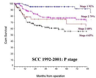 Graph showing survival for squamous celll carcinomas treated by the Regional Maxillofacial Unit